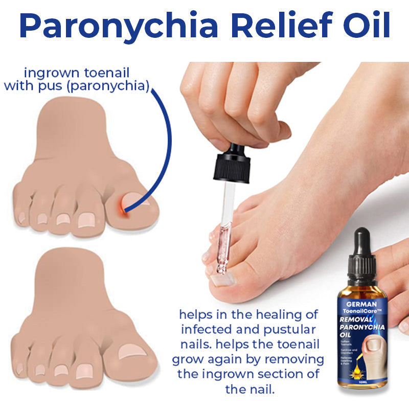 German ToenailCare™ Removal Paronychia Oil