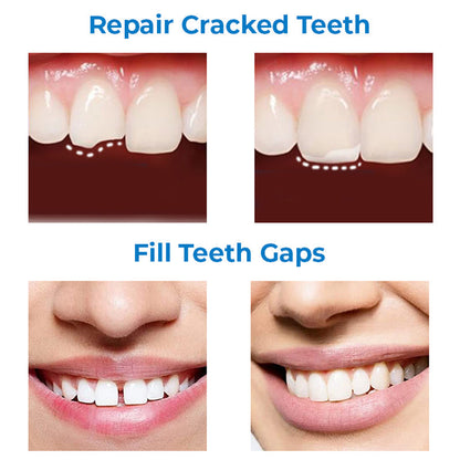 OraClean Tooth Repair Shaping Teether Kit