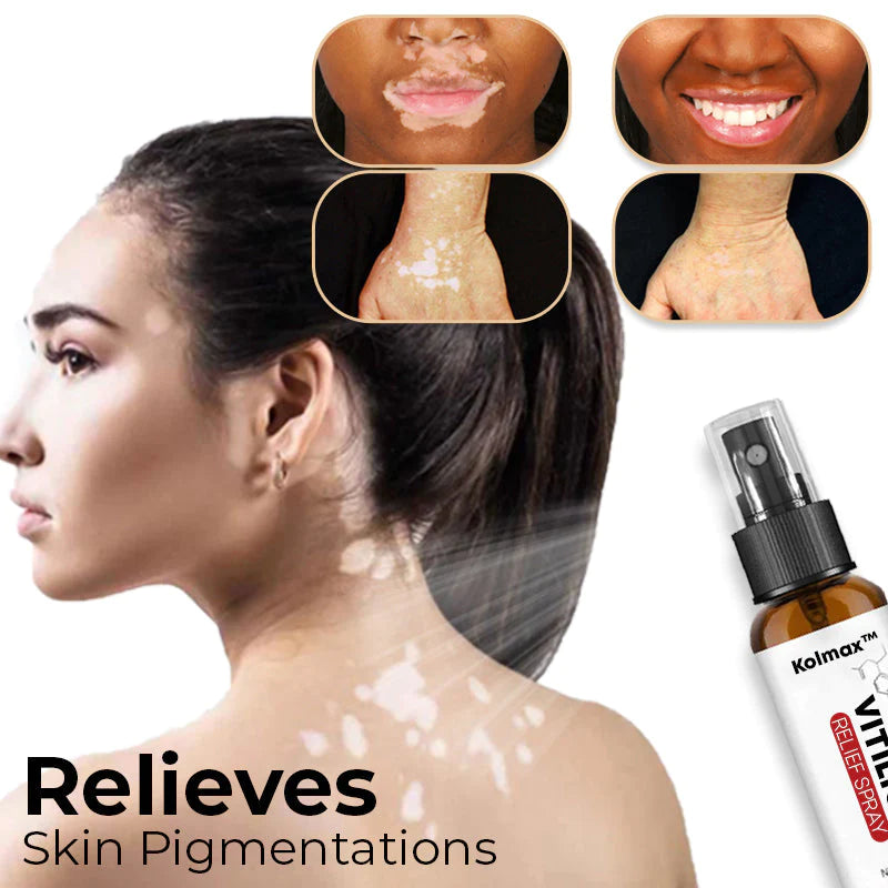 Kolmax™ Vitiligo Relief Spray