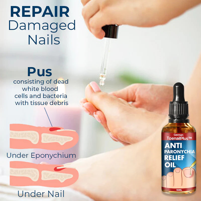 German ToenailPlus™ Anti Paronychia Relief Oil