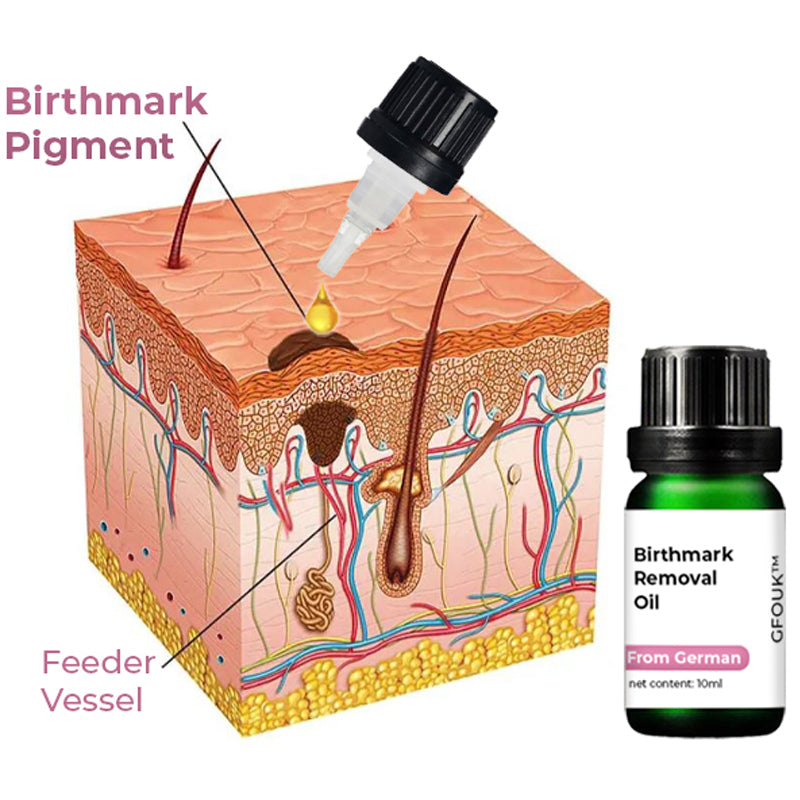 GFOUK™ German Birthmark Removal Oil